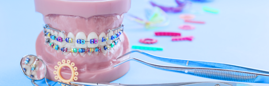 orthodontics-ppc-agency